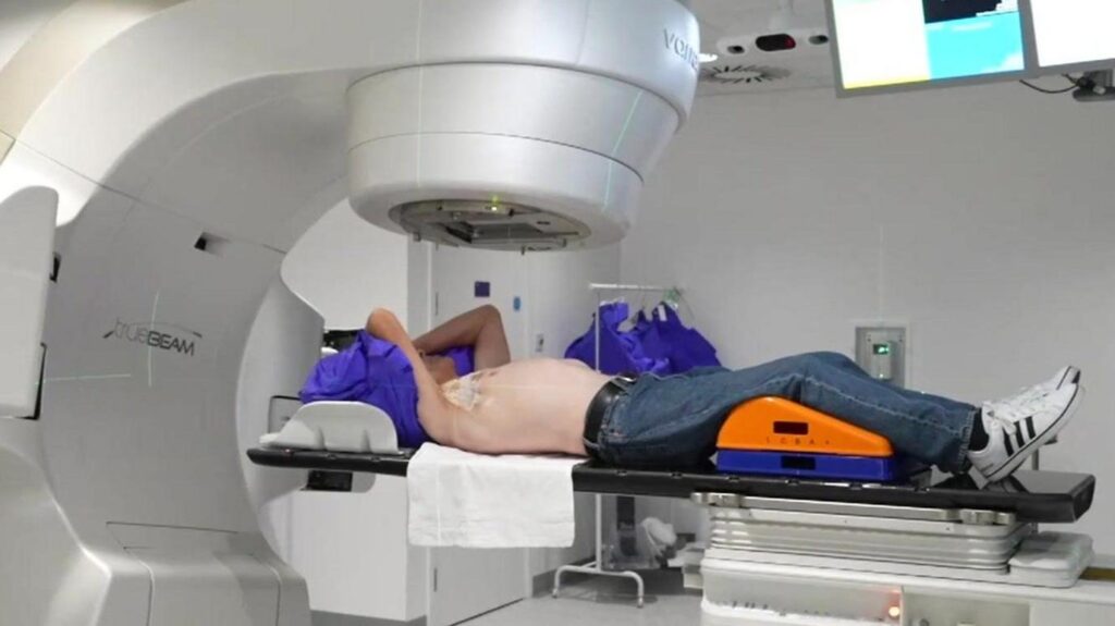 Radiation Therapy for Cancer