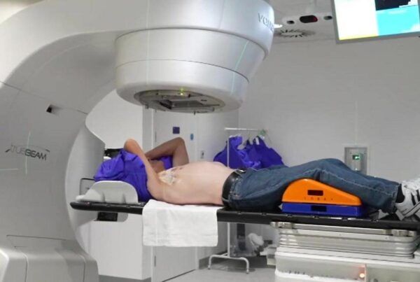 Radiation Therapy for Cancer