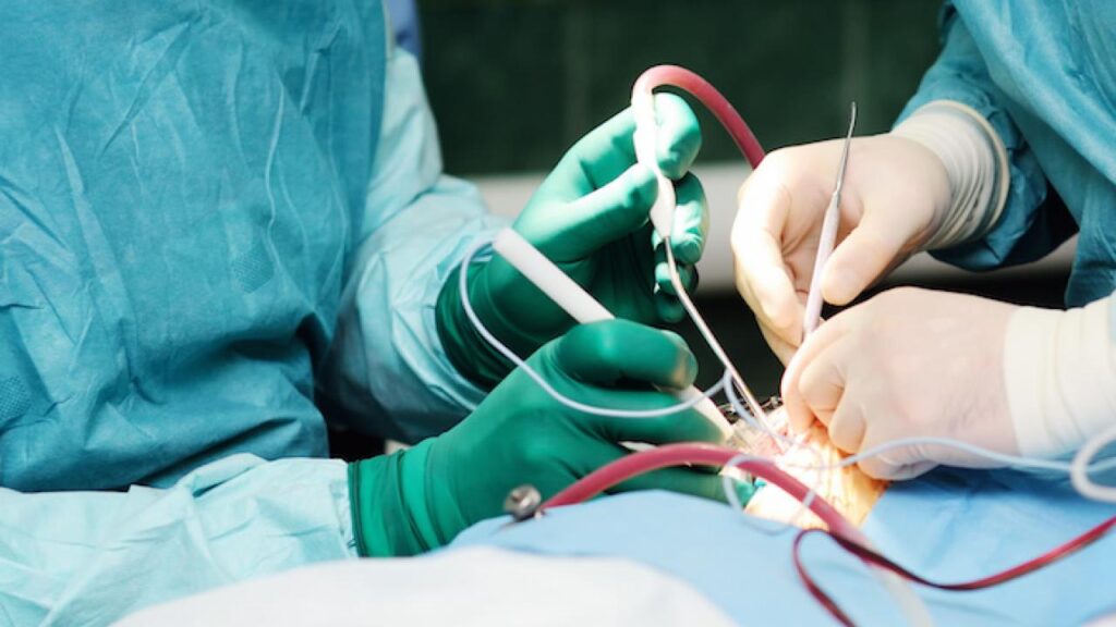 Tumor Resection Surgery