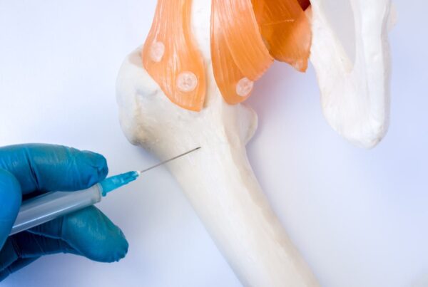 لماذا وكيف يمكن تركيب مفاصل مخصصة للأورام؟