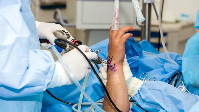 Surgery Arthritis