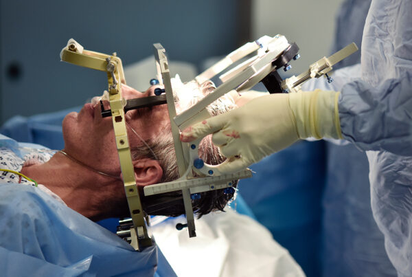 عملية الباركنسون