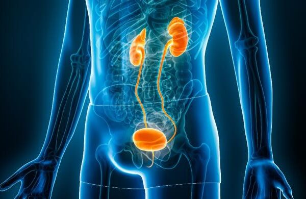 اورام المسالك البولية: أنواعها وعلاجاتها