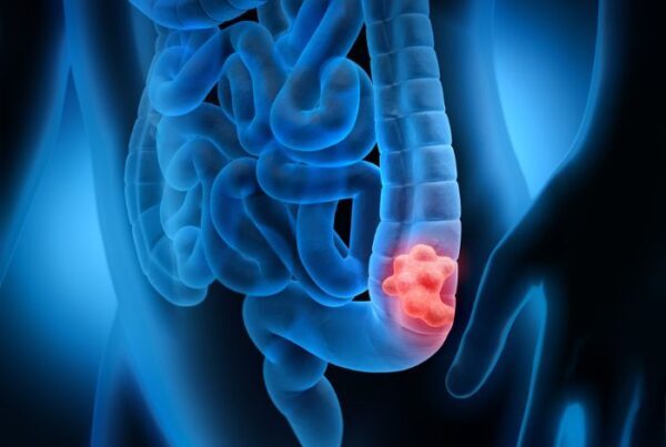 عملية استئصال القولون