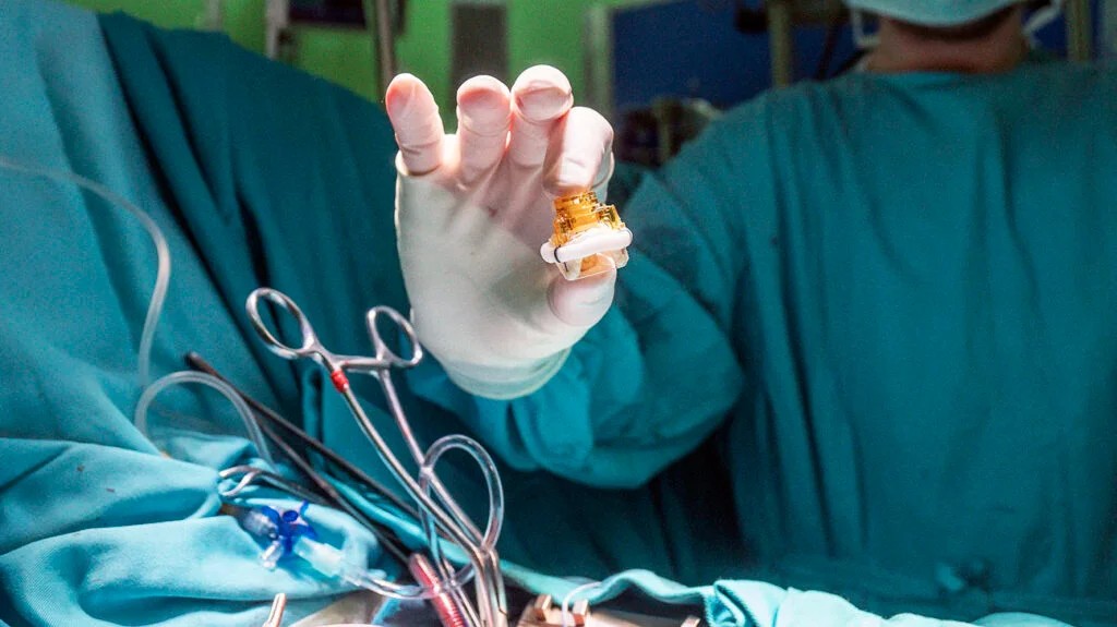 What is Heart Valve Replacement Surgery?